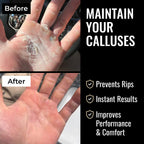 SandBar 8" Callus Kit
