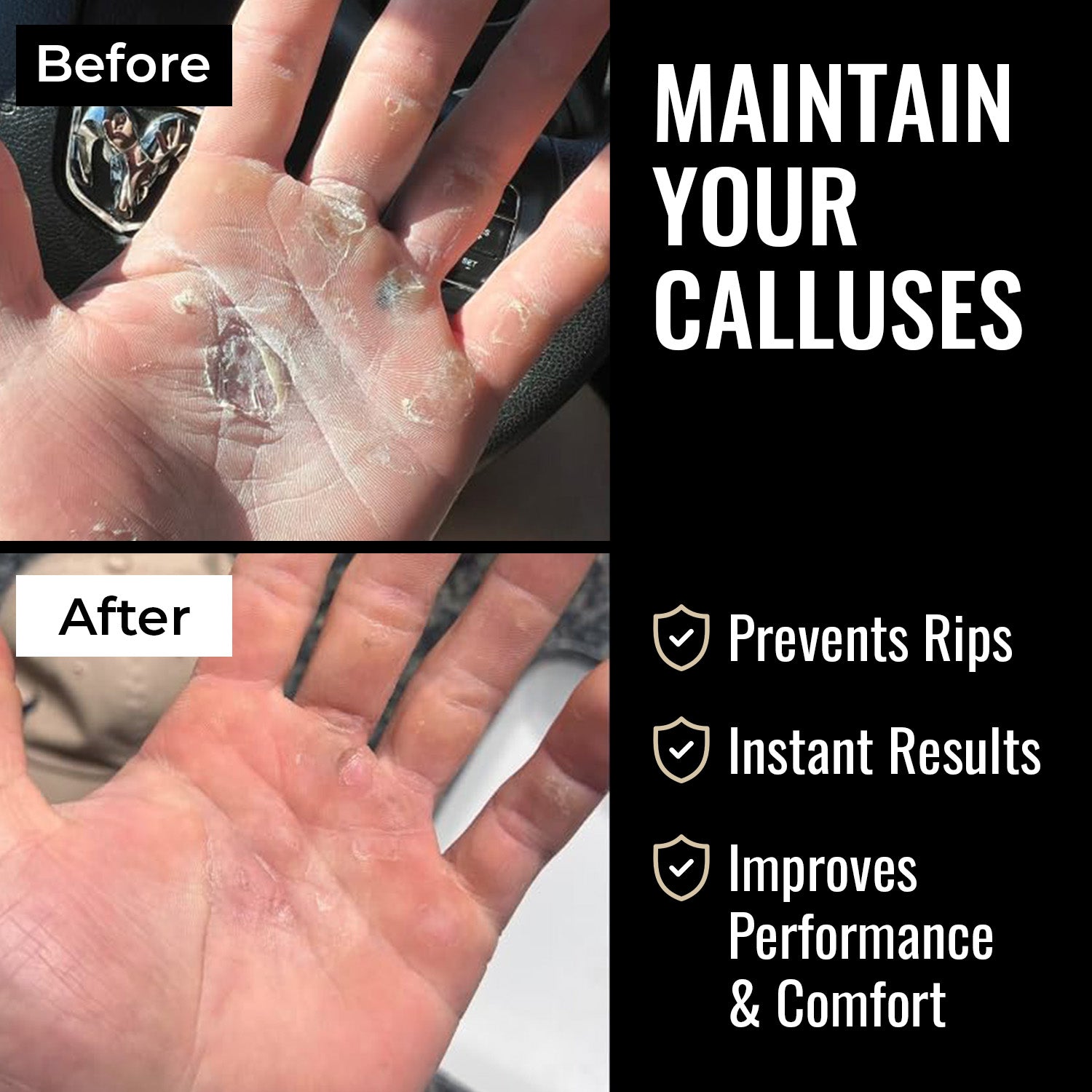 SandBar 4" Quickie Callus Kit